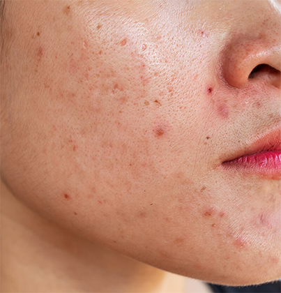 Hair Care Clinic in Tambaram