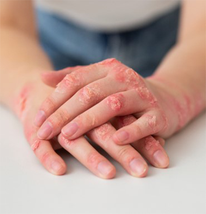 Skin Doctor in Tambaram