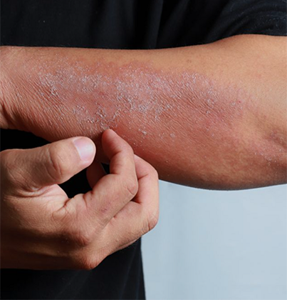 Skin Doctor in Tambaram