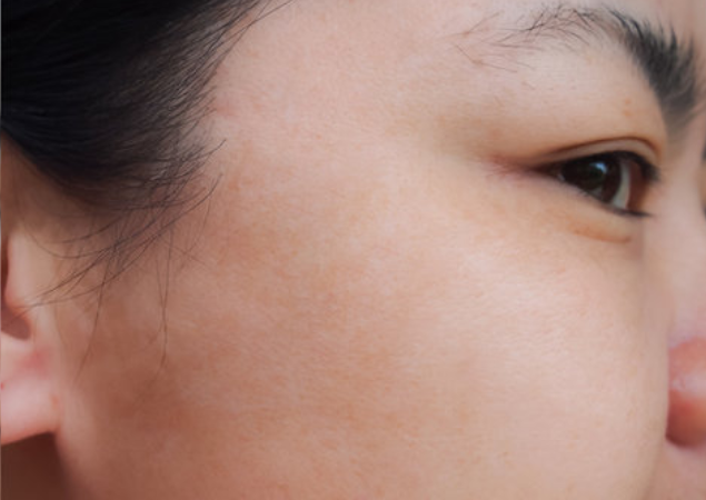 Aarokya Skin & Hair Clinic in Chennai