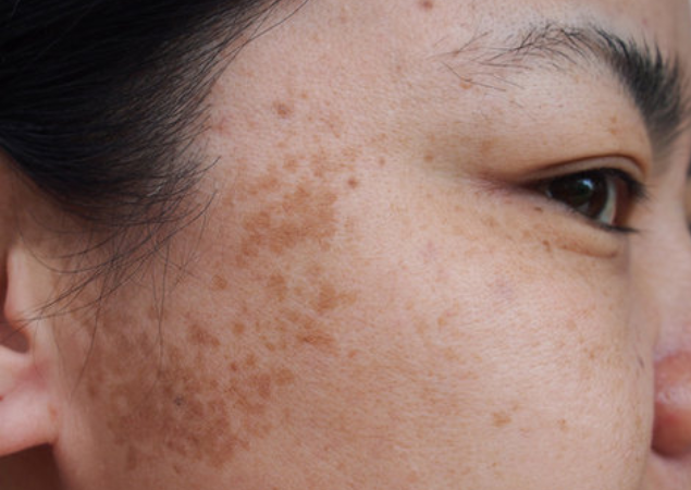 Aarokya Skin & Hair Clinic